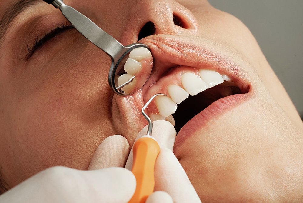 Person receiving dental care